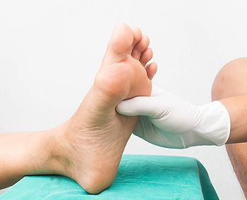 Diabetic foot problem