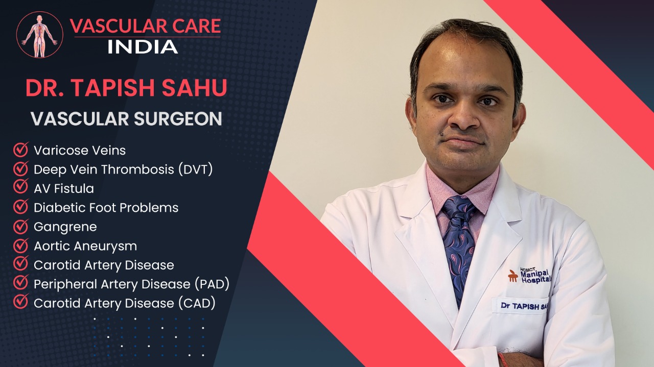 varicose veins are worse than spider veins