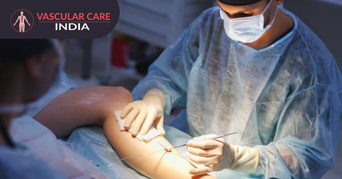 Best Vascular Surgeon Doctor in Delhi NCR,