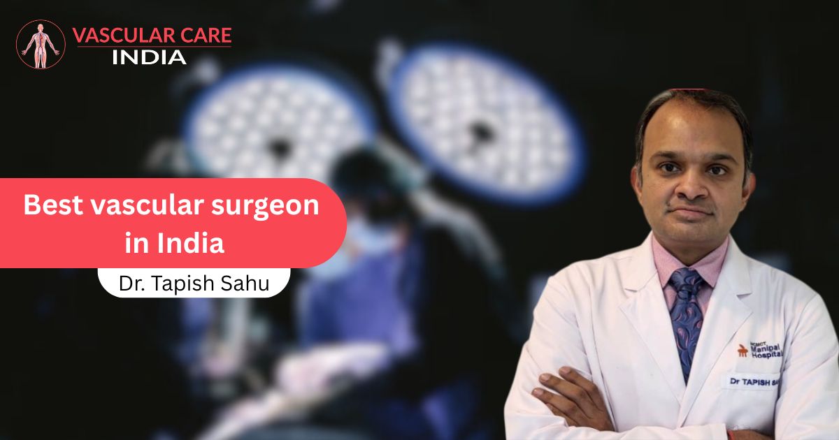 Best Vascular surgeon in India